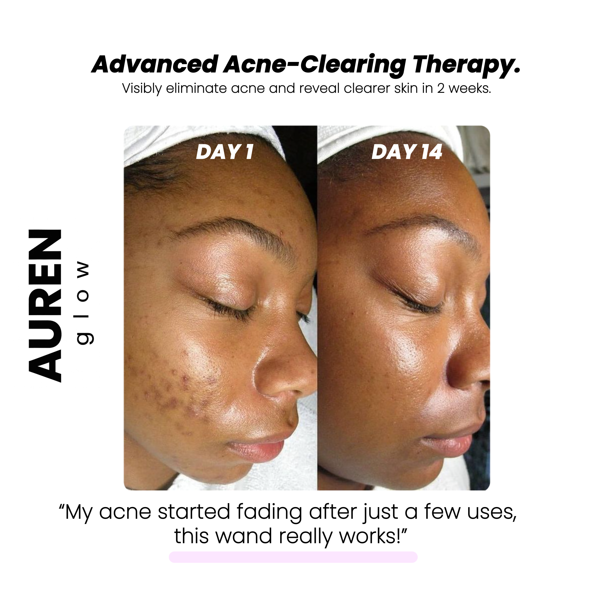 High Skin Therapy Wand