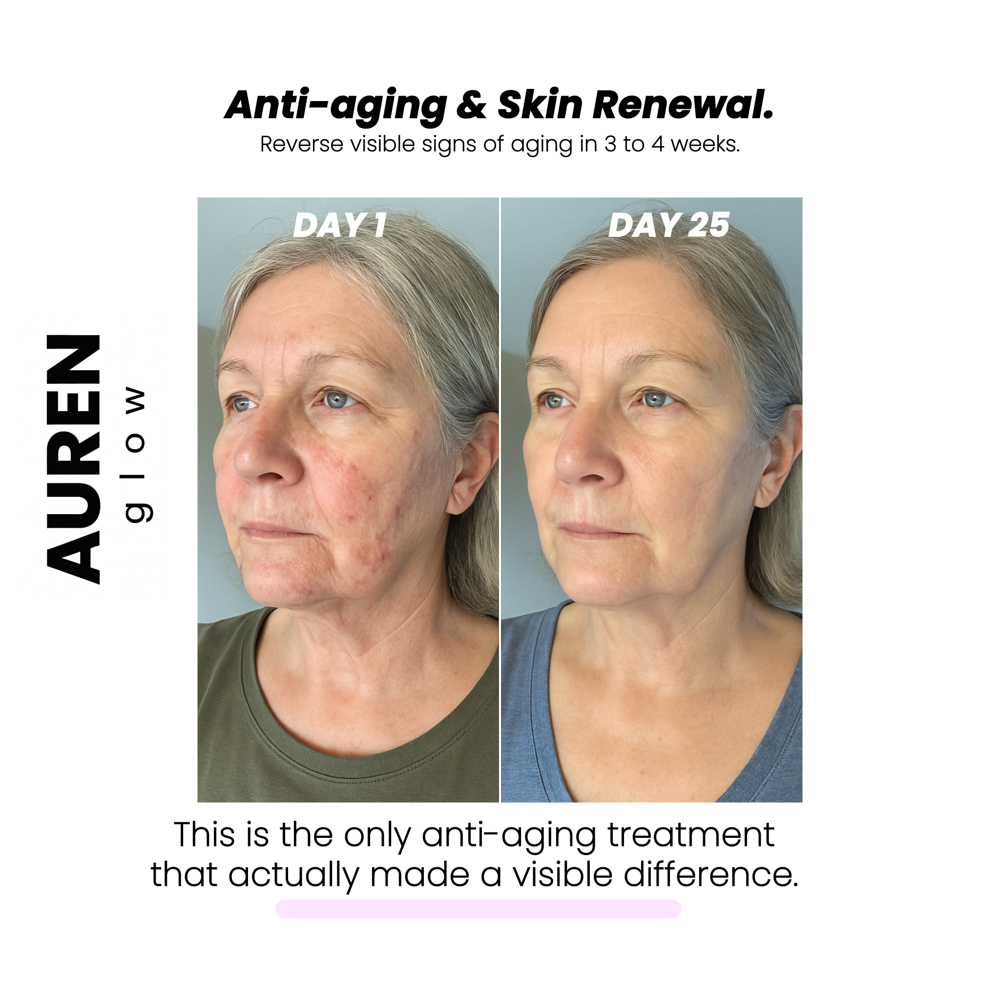 High Skin Therapy Wand